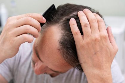 Cara mengatasi rambut rontok secara alami