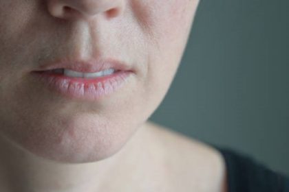 Bibir pecah-pecah tak hanya mengganggu penampilan, tapi juga bisa terasa perih dan tak nyaman. Kondisi ini terjadi karena bibir kekurangan kelembapan, sehingga kulit bibir menjadi kering, mengelupas, dan bahkan retak.