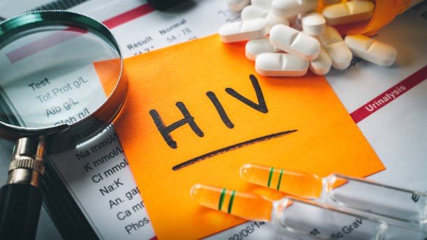 Kasus HIV/AIDS di Banda Aceh menunjukkan tren yang mengkhawatirkan, dengan total 441 kasus terhitung hingga Mei 2024. Dari jumlah tersebut, 336 kasus merupakan HIV dan 105 kasus AIDS.