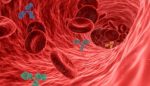 Mengenal Penyakit Arteri Perifer, Penyebab dan Cara Mengatasinya